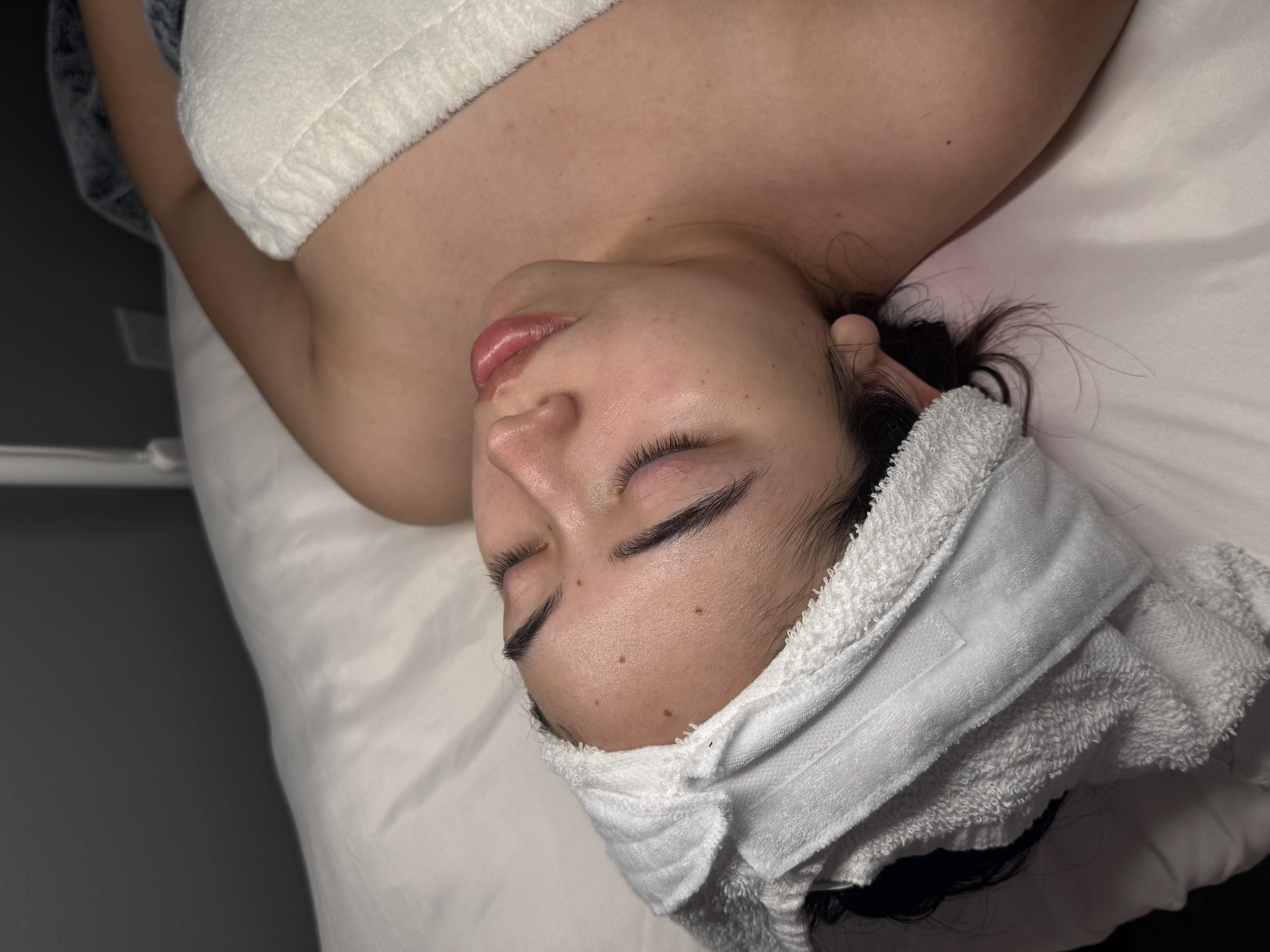 Facial Treatment
