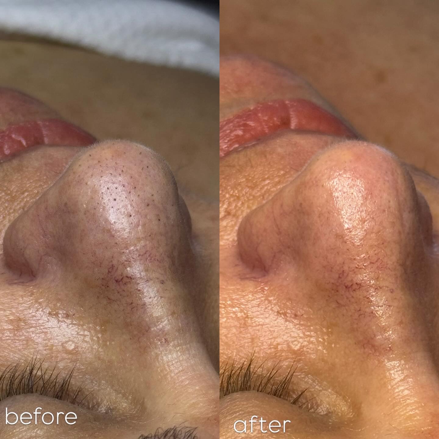 Facial Treatment