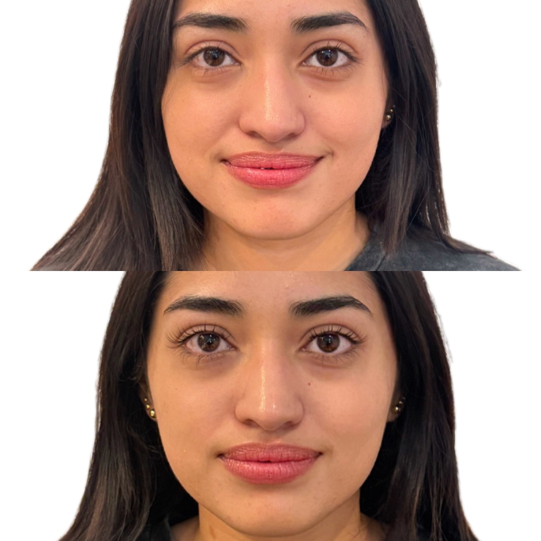 Lash Lift