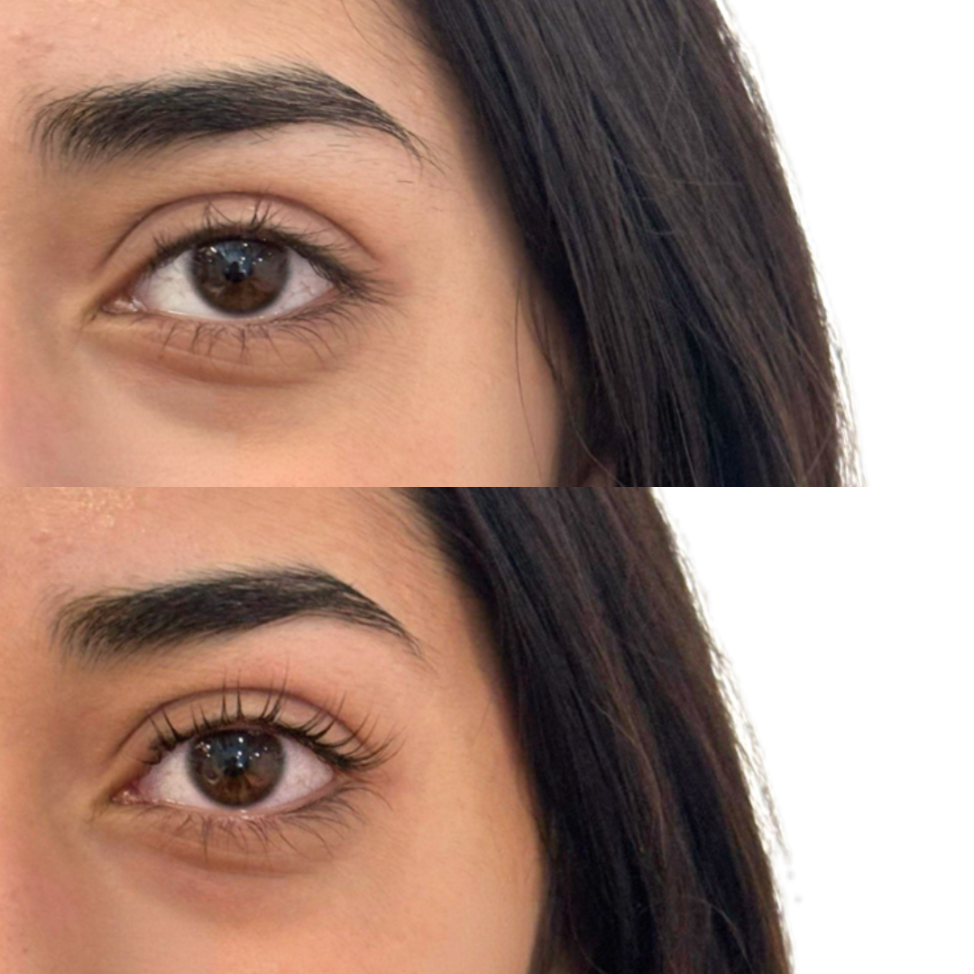 Lash Lift